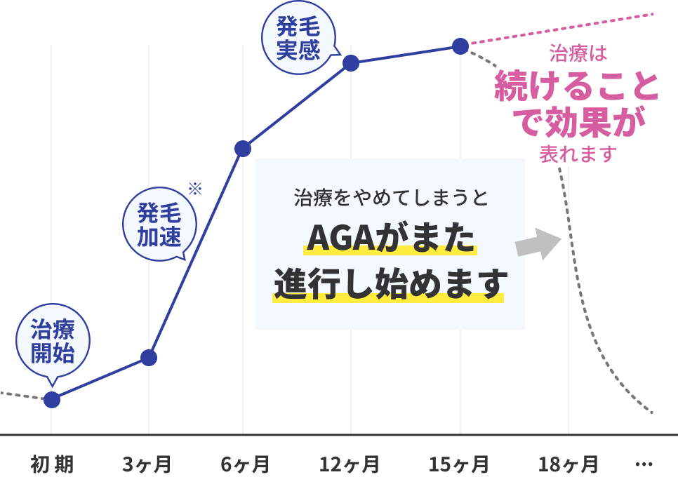 発毛イメージ図