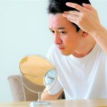 発毛剤は本当に効果ある？【効果的な使い方も解説】