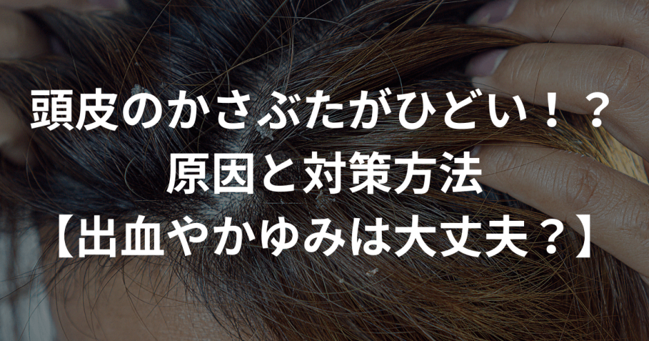 頭皮　かさぶた