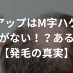 リアップはM字ハゲに効果がない！？ある？！【発毛の真実】