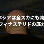プロペシアは全スカにも効くの?【フィナステリドの底力】