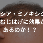 プロペシア・ミノキシジルはつむじはげに効果があるのか！？