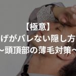 【極意】つむじはげがバレない隠し方まとめ！〜頭頂部の薄毛対策〜