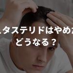 デュタステリドはやめたらどうなる？AGA治療のやめどきについても解説！