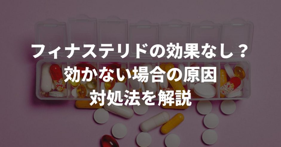 AGA治療薬　フィナステリド　効果なし