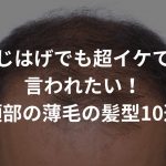 つむじはげでも超イケてると言われたい！頭頂部の薄毛の髪型10選！