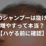 h&sのシャンプーは抜け毛を増やす？【ハゲる前に確認】口コミや評判を検証