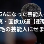 AGAになった芸能人の写真・画像10選【衝撃】〜薄毛の芸能人にせまる〜