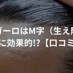 ザガーロはM字（生え際）の薄毛に効果的!?【口コミあり】