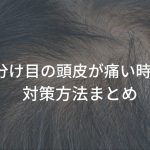 分け目を変えると痛い、頭皮が痛い原因とその対策方法