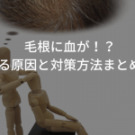 毛根に血が！？考えられる原因と対策方法まとめ【注意】