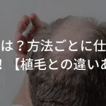 増毛とは？方法ごとに仕組みを紹介！【植毛との違いあり】