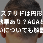 フィナステリドは円形脱毛症に効果あり？AGAとの違いについても解説！