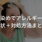 白髪染めでアレルギーに！？原因となる成分と症状＋対処方法まとめ