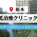 【栃木】植毛治療が可能な評判の高いクリニック5選｜AGAを直すために大切なことも教えます!