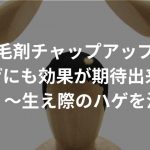 育毛剤チャップアップはM字はげにも効果が期待出来る！？【必見】〜生え際の薄毛を治す！〜