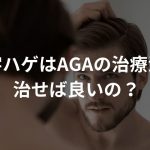 M字ハゲはAGAの治療法で治せば良いの？