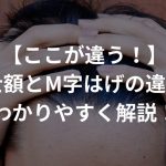 【ここが違う！】富士額とM字はげの違いをどこよりもわかりやすく解説！