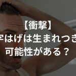 【衝撃】M字はげは生まれつきの可能性がある！？