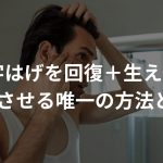 M字はげを回復＋生え際を復活させる唯一の方法とは！？そんなのあるの？