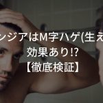 フィンジアはM字ハゲ(生え際)に効果あり!?【徹底検証】