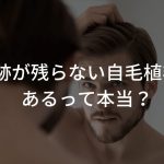 傷跡が残らない自毛植毛があるって本当？