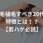 自毛植毛すべき20代の特徴とは！？【若ハゲ必読】