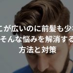 おでこが広いのに前髪も少ない…そんな悩みを解消する方法と対策