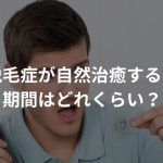 円形脱毛症が自然治癒するまでの期間はどれくらい？【体験談あり】