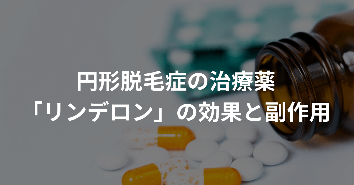 円形脱毛症の治療薬「リンデロン」の効果と副作用を徹底解説！ AGAスマクリマガジン