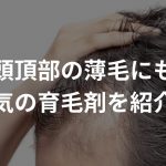 頭頂部の薄毛にも人気の育毛剤を紹介！〜ハゲを回復〜