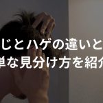 つむじとハゲの違いってなに？【簡単な見分け方を紹介！】