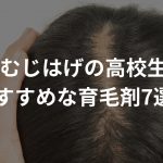 つむじはげの高校生におすすめな育毛剤7選！【厳選】〜若ハゲを安価に治す〜