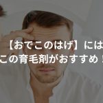 【おでこのはげ】にはこの育毛剤がおすすめ！〜最適なM字はげ対策法〜