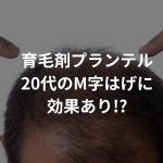 育毛剤プランテルは20代のM字はげに効果あり!?