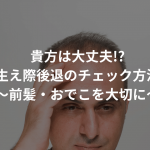 貴方は大丈夫!?生え際後退のチェック方法まとめ〜前髪・おでこを大切に〜