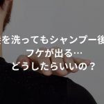 髪を洗ってもシャンプー後にフケが出る…どうしたらいいの？