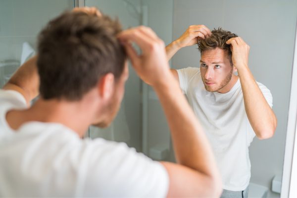 円形脱毛症の再発を防ぐ方法