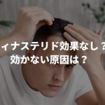 フィナステリドが効かない？その原因や対策方法もまとめてご紹介