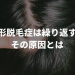 円形脱毛症は繰り返す？6つの原因や治療方法などを徹底解説！