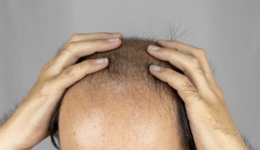 抜け毛の原因は主に12種類｜注意すべき抜け毛はどんな抜け毛？